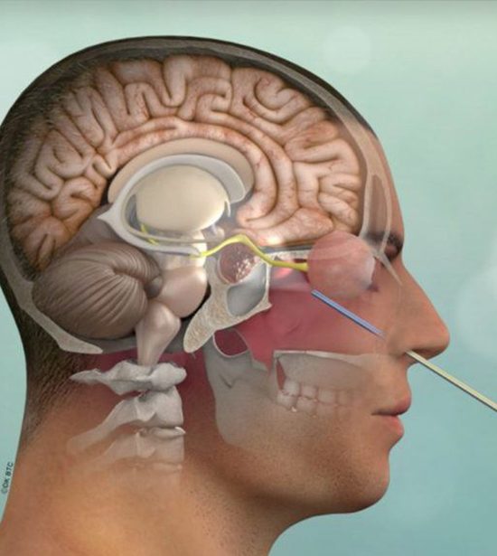 Endoscopic Brain Surgery