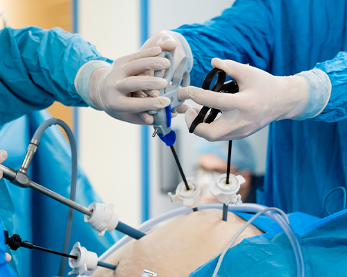 Minimally Invasive Neurosurgery